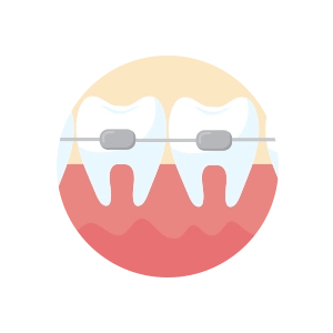牙科矯正患者圖